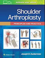 Shoulder Arthroplasty: Principles and Practice 