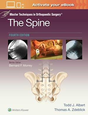 Master Techniques in Orthopaedic Surgery: The Spine