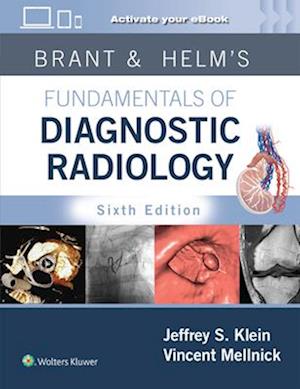 Brant & Helm's Fundamentals of Diagnostic Radiology