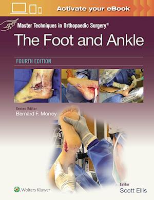 Master Techniques in Orthopaedic Surgery: The Foot and Ankle