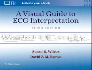 A Visual Guide to ECG Interpretation: Print + eBook with Multimedia