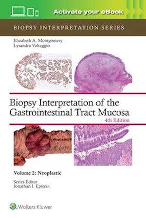 Biopsy Interpretation of the Gastrointestinal Tract Mucosa Volume 2