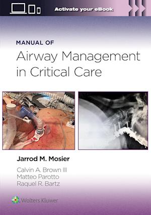 Manual of Airway Management in Critical Care: Print + eBook with Multimedia