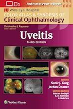 Uveitis