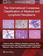 The International Consensus Classification of Myeloid and Lymphoid Neoplasms