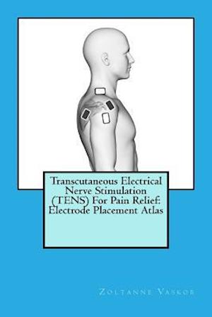 Transcutaneous Electrical Nerve Stimulation (Tens) for Pain Relief