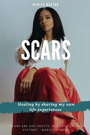 Scars