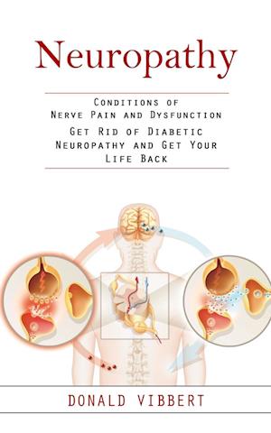 Neuropathy