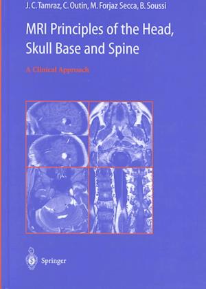 MRI Principles of the Head, Skull Base and Spine