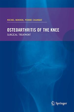 Osteoarthritis of the knee