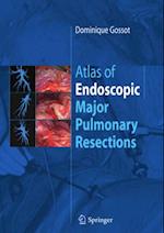 Atlas of endoscopic major pulmonary resections