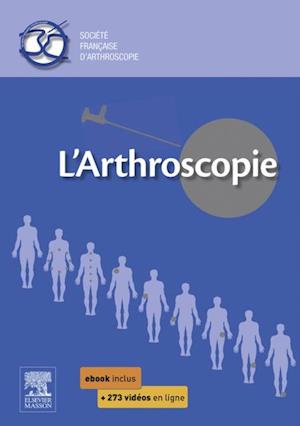 L''arthroscopie