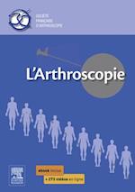 L''arthroscopie