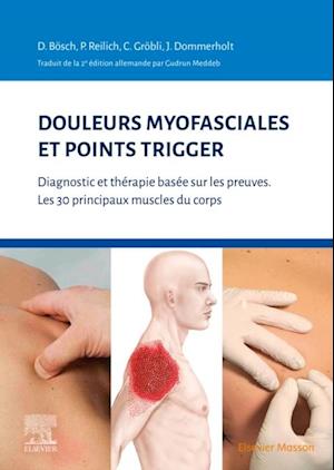 Douleurs myofasciales et points trigger