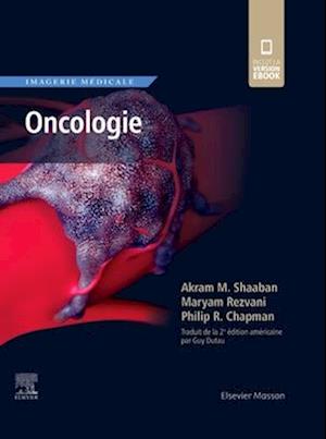 Imagerie médicale : Oncologie