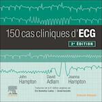 150 Cas Cliniques d'Ecg