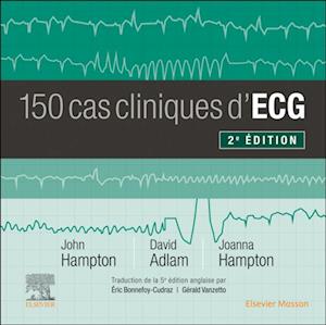 150 cas cliniques d''ECG