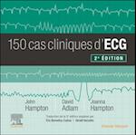 150 cas cliniques d''ECG