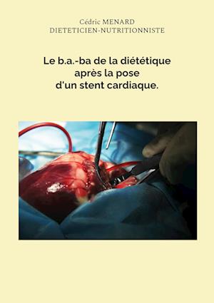 Le b.a.-ba de la diététique après la pose d'un stent cardiaque.