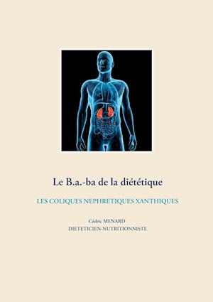 Le b.a-ba de la diététique pour les coliques néphrétiques xanthiques