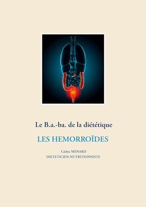 Le b.a-ba de la diététique pour les hémorroïdes