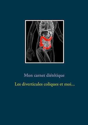 Mon carnet diététique : les diverticules coliques et moi...