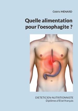 Quelle alimentation pour l'oesophagite ?