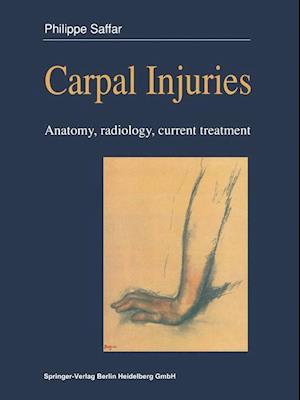 Carpal injuries