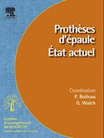 Prothèses d''épaule. État actuel