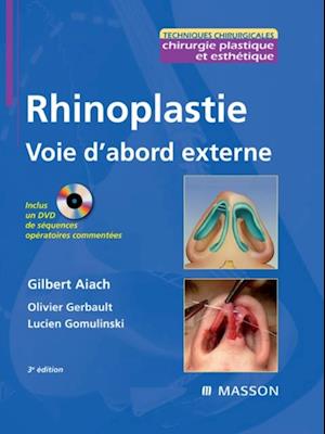 Rhinoplastie. Voie d''abord externe