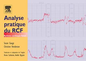 Analyse pratique du RCF