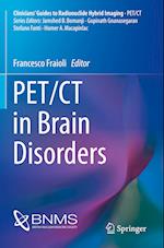 PET/CT in Brain Disorders
