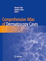 Comprehensive Atlas of Dermatoscopy Cases