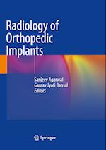 Radiology of Orthopedic Implants