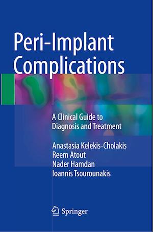 Peri-Implant Complications