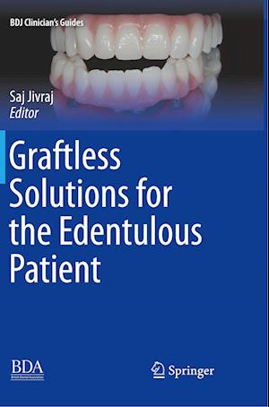 Graftless Solutions for the Edentulous Patient