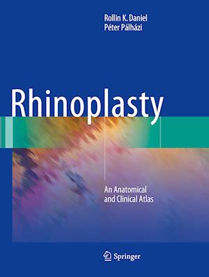 Rhinoplasty