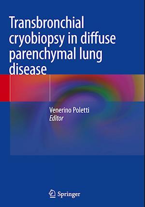 Transbronchial cryobiopsy in diffuse parenchymal lung disease