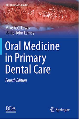 Oral Medicine in Primary Dental Care