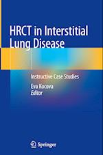 HRCT in Interstitial Lung Disease
