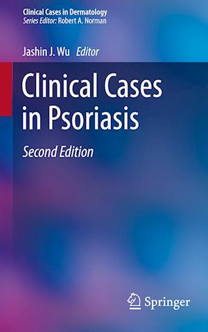 Clinical Cases in Psoriasis