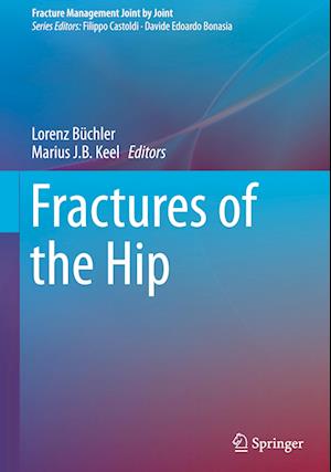 Fractures of the Hip