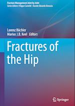 Fractures of the Hip