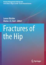 Fractures of the Hip