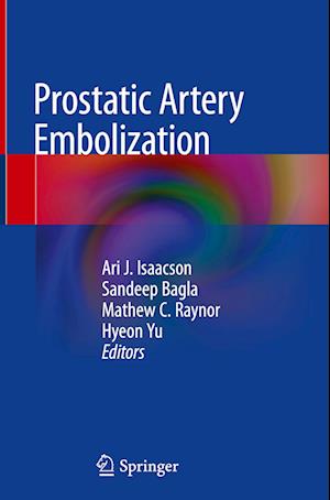 Prostatic Artery Embolization