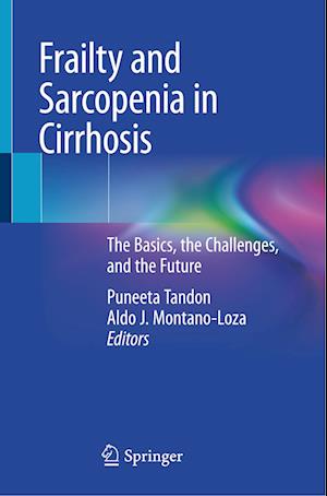 Frailty and Sarcopenia in Cirrhosis