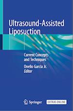 Ultrasound-Assisted Liposuction