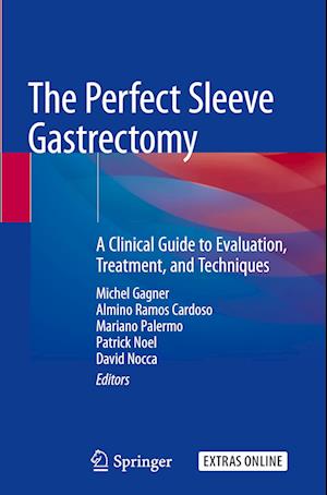 The Perfect Sleeve Gastrectomy