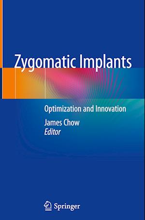 Zygomatic Implants