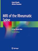 MRI of the Rheumatic Spine